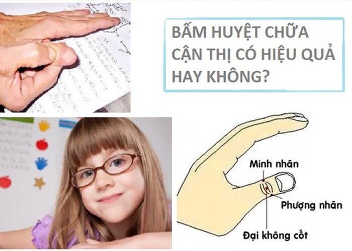 Chữa Cận Thị Bằng Phương Pháp Dân Gian Có Thực Sự Hiệu Quả Không?