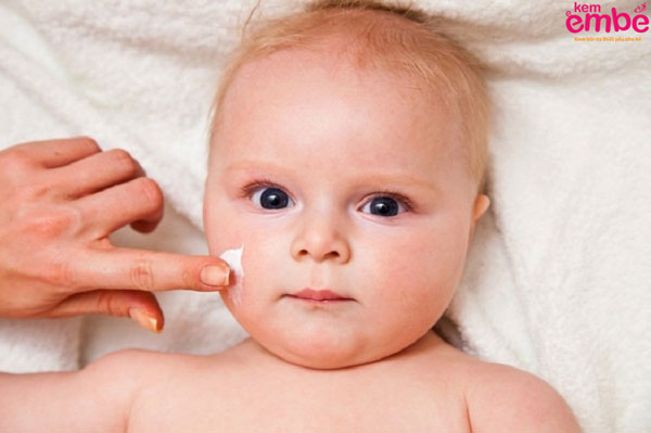 Tư vấn cách trị muỗi đốt trên da mặt cho trẻ trên nguyên liệu dễ tìm
