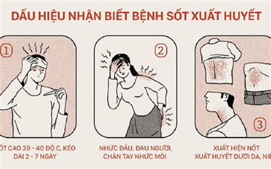 Dấu hiệu và cách tự phòng tránh sốt xuất huyết cho cả gia đình